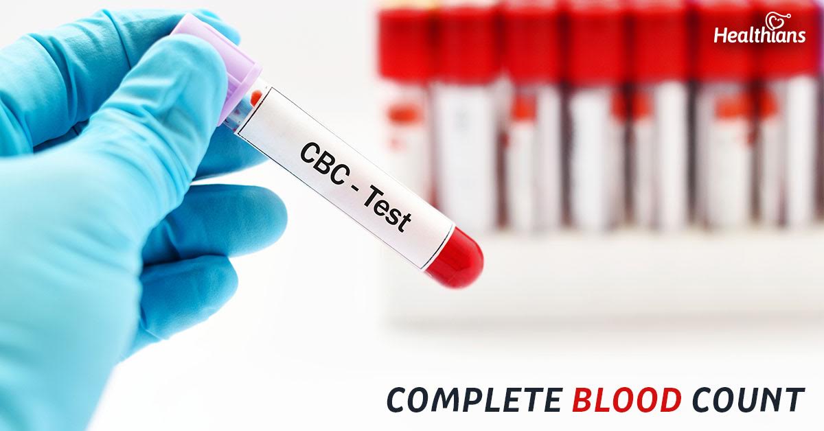 reading cbc blood test results