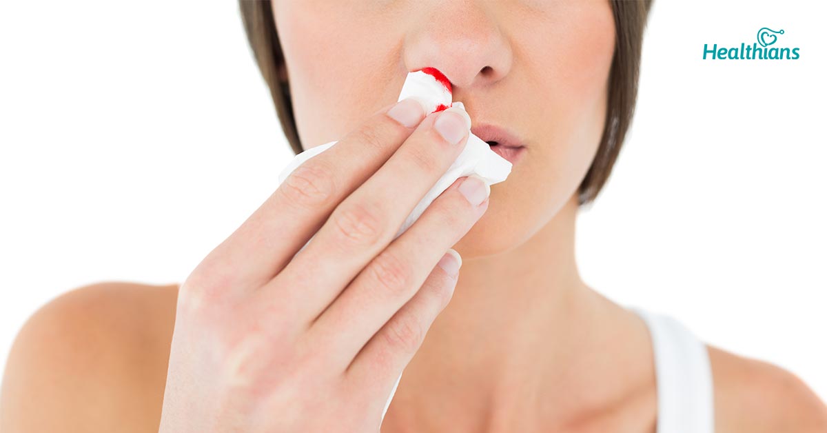 why-does-nose-bleed-healthians-blog