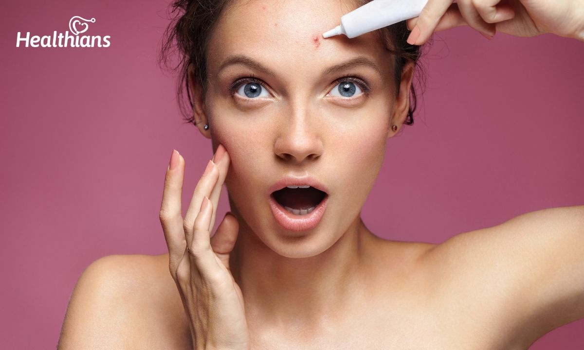 Do you get pimples in the same spot? Know the shocking reasons!