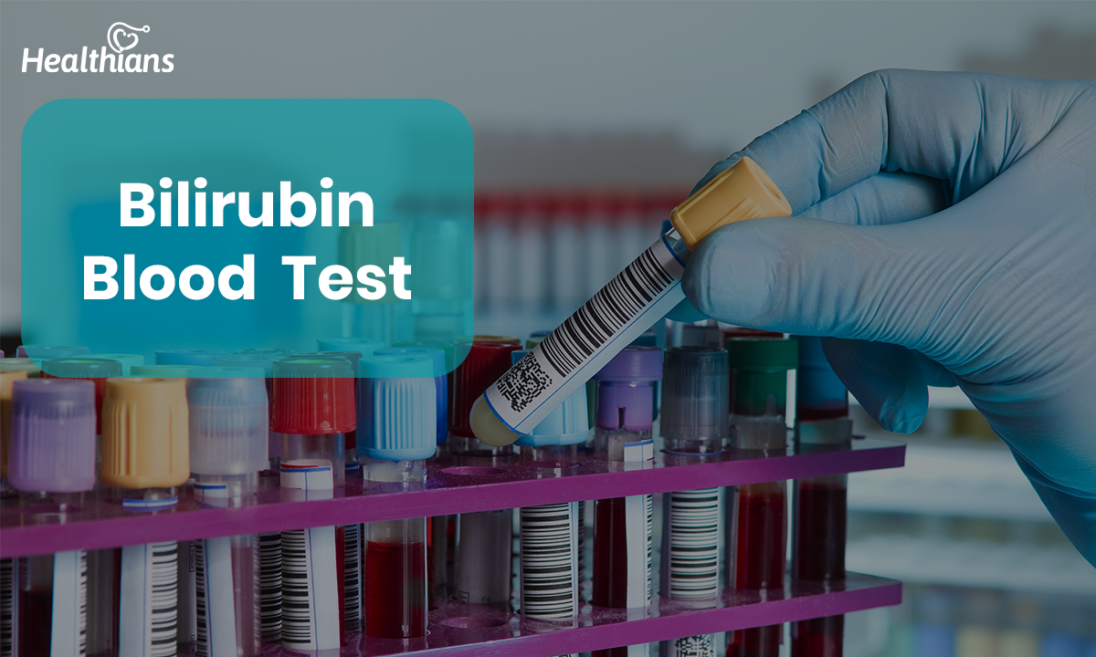 Bilirubin Blood Test High Vs Low Levels Direct Vs Indirect