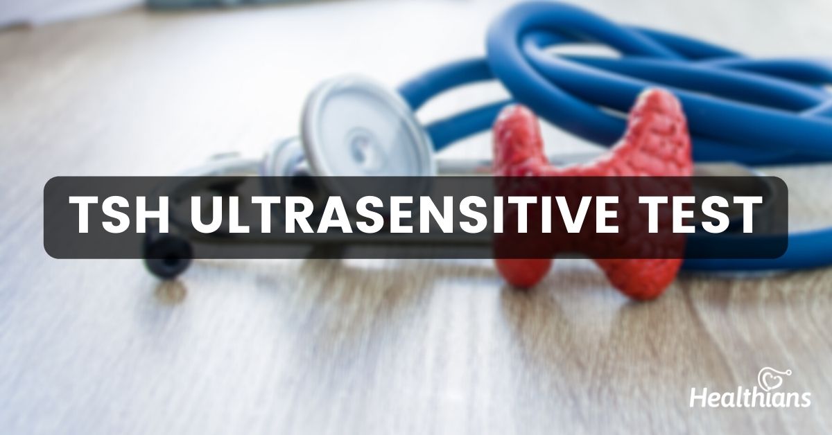 TSH Ultrasensitive Test - HEALTHIANS BLOG