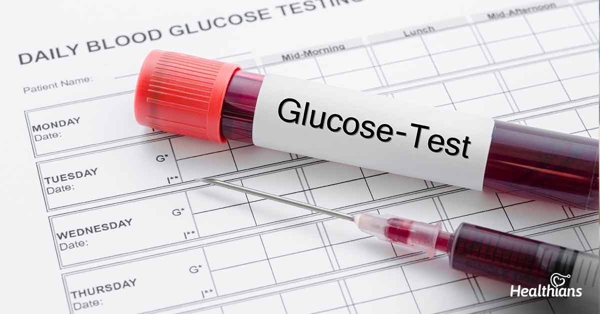 name of blood sugar test