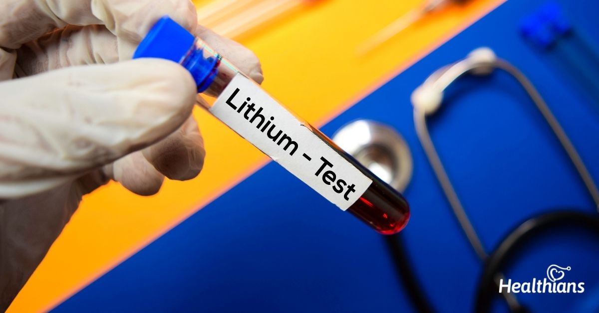 Lithium Test Need, Results & Reference Range HEALTHIANS BLOG