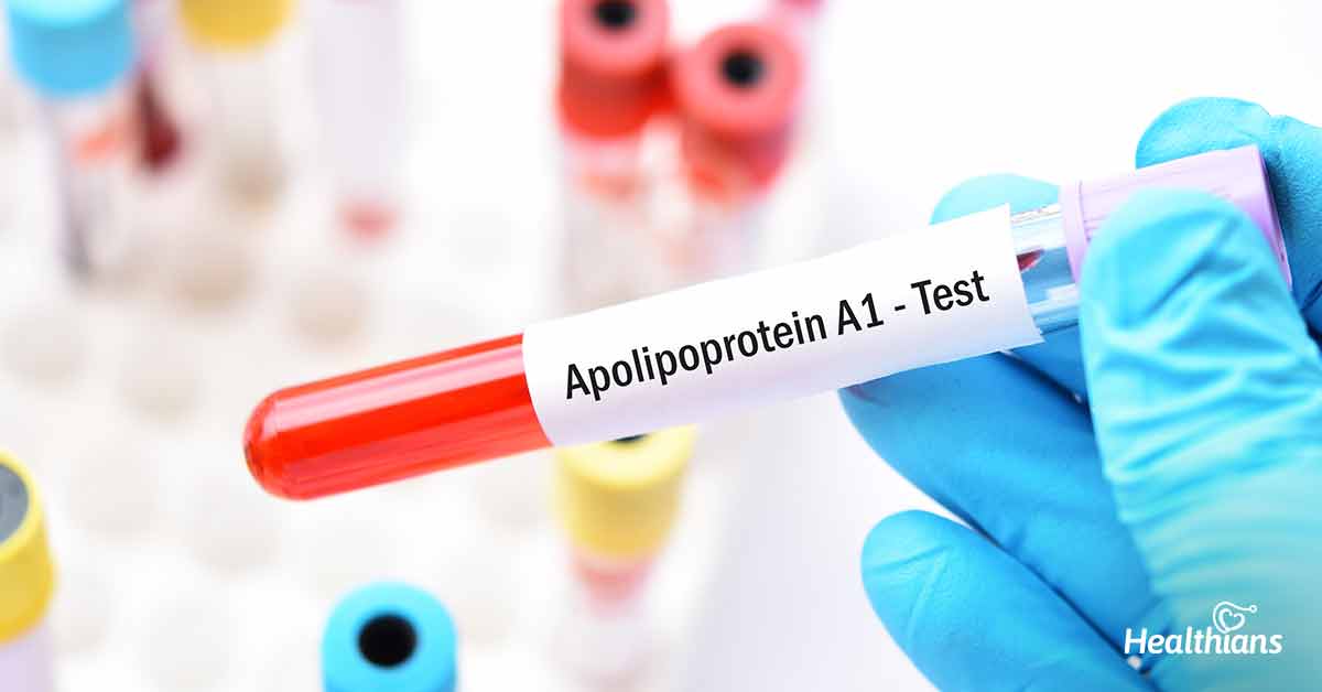 Apolipoprotein A-1 Test (Apo-A1) - HEALTHIANS BLOG