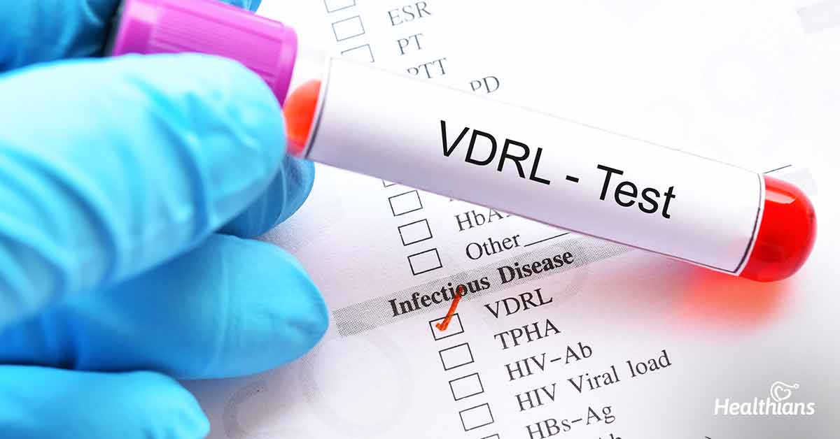 Venereal Disease Research Laboratory Vdrl Test Healthians Blog