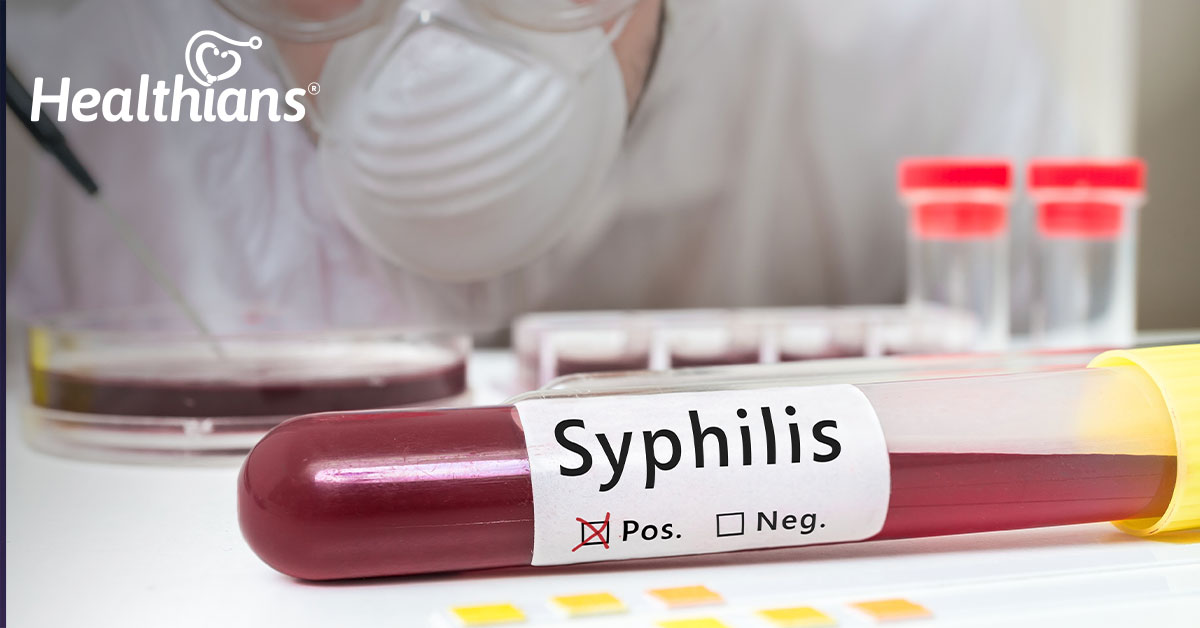 What Is Syphilis Disease? Signs and Stages