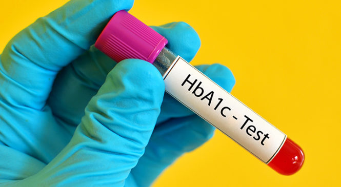 Understanding Your HbA1c Results For Diabetes