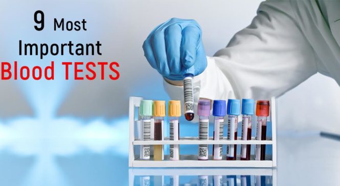 9 Most Important Blood Tests