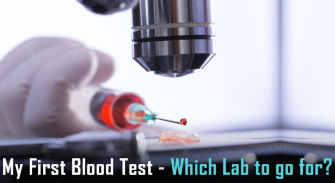 My First Blood Test – Which Lab To Go For?