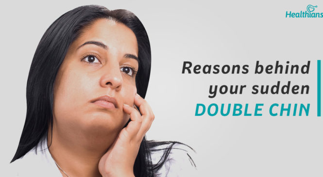 5 Things Your Double Chin Tells About Your Health