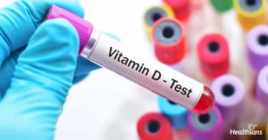 The important tests for vitamin D 