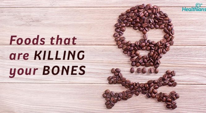 Bone Health And Your Diet: Foods That Are Bad For Your Bones