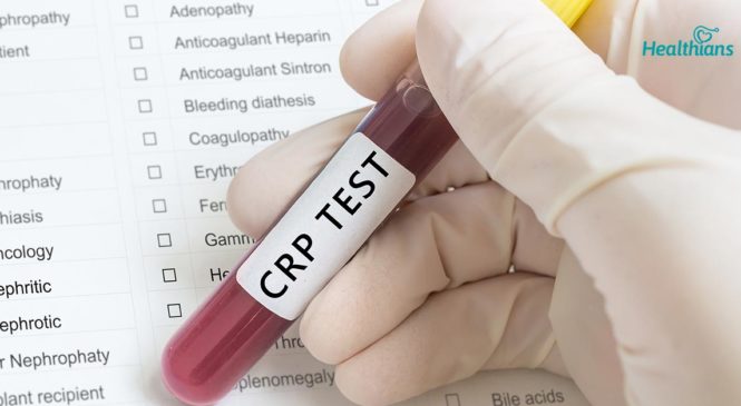 Understanding CRP Blood Test