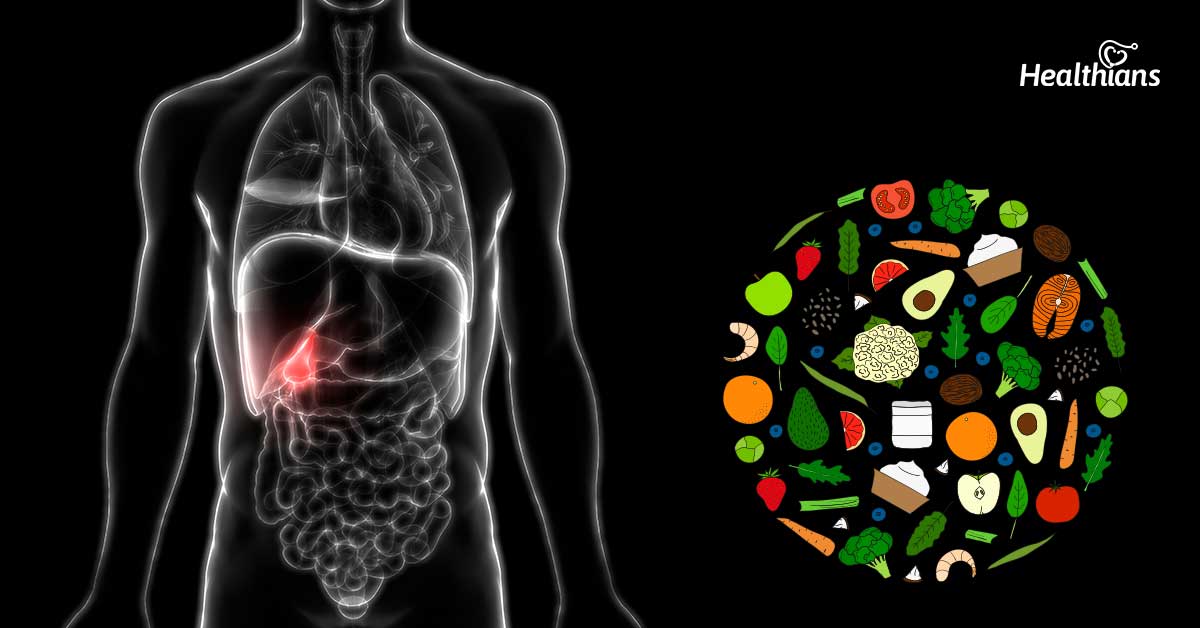 dietary do's & dont's for gallbladder stones