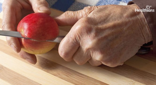 Arthritis: The Dietary Do’s And The Don’ts