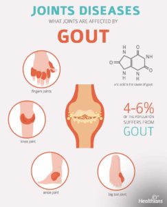 Gout: Signs & Symptoms - HEALTHIANS BLOG