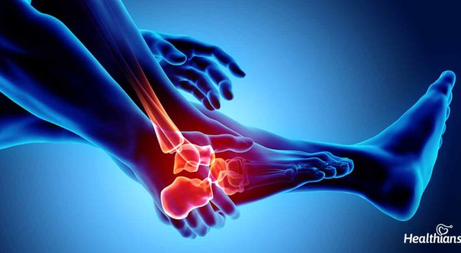 Guidebook to Manage Your Arthritis