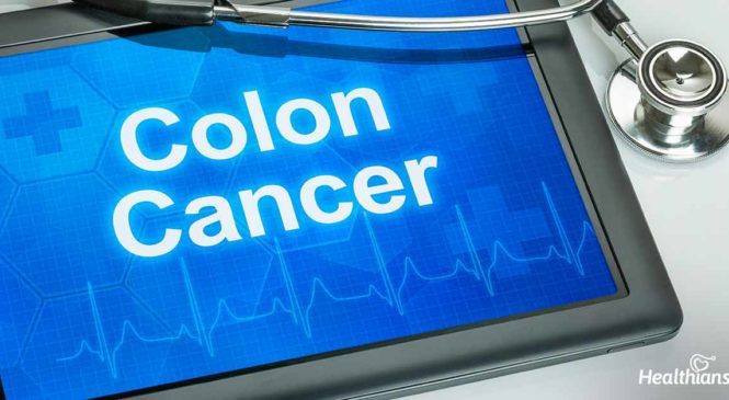 Colon Cancer – The Third Most Deadly Cancer In The World