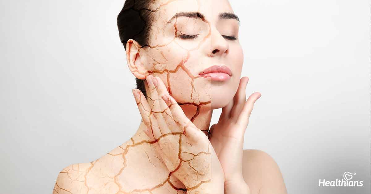 Dry skin during winter - Healthians