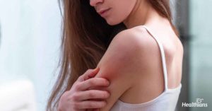 Skin rashes in HIV - Healthians