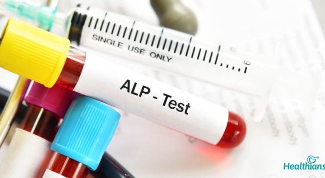 Alkaline Phosphatase Test