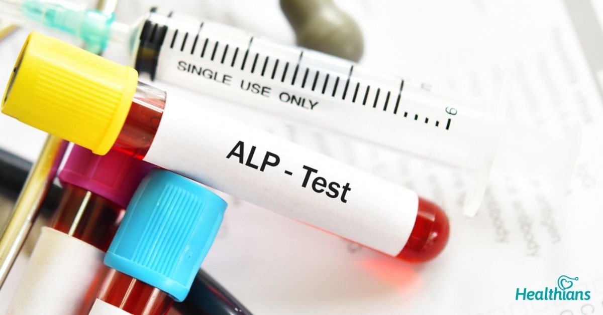 Alkaline Phosphatase Test HEALTHIANS BLOG