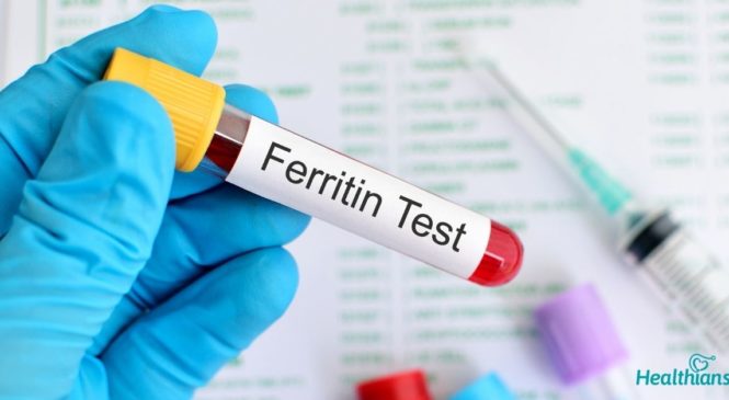 Ferritin blood test: High vs Low Ferritin Levels, Normal Range
