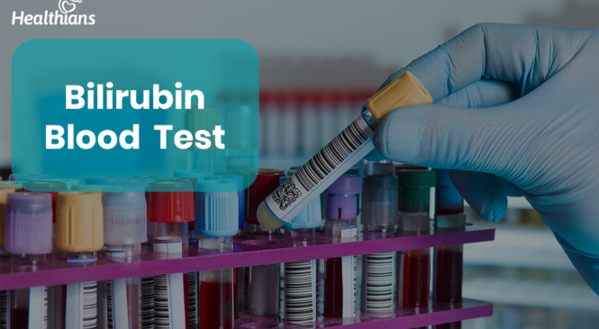Bilirubin Blood Test:  High vs. Low Levels, Direct vs. Indirect