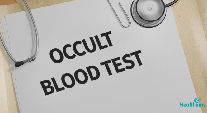 Fecal Occult blood test (FOBT) – All that you should know