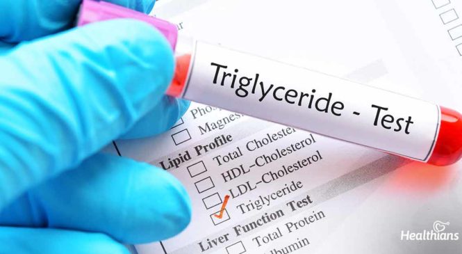 Triglycerides serum test: Why does it matter?