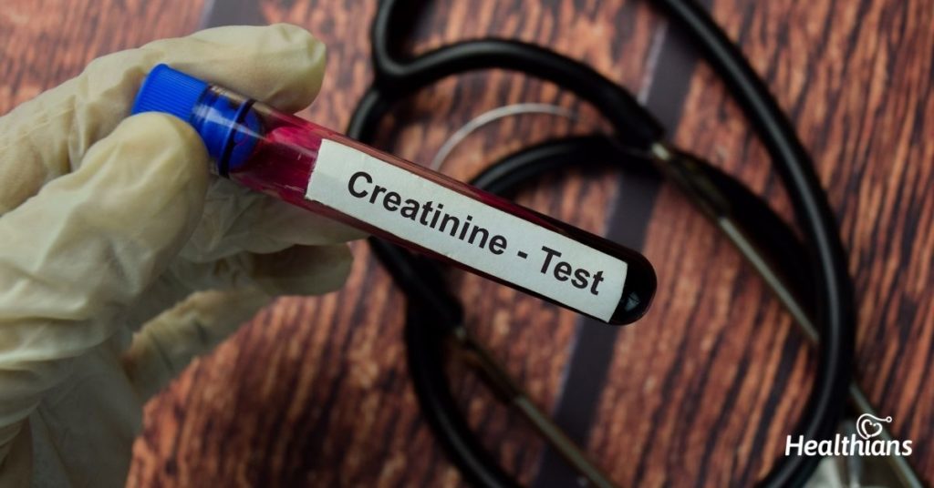 creatinine-serum-test-everything-you-need-to-know