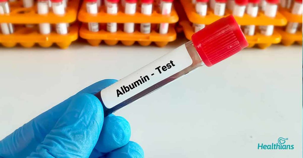 Serum Albumin Test: A test to check liver functions