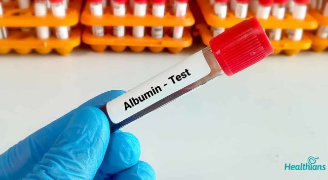 Serum Albumin Test: A test to check liver functions