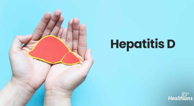 Hepatitis D: Symptoms, causes, diagnosis, treatment, and prevention