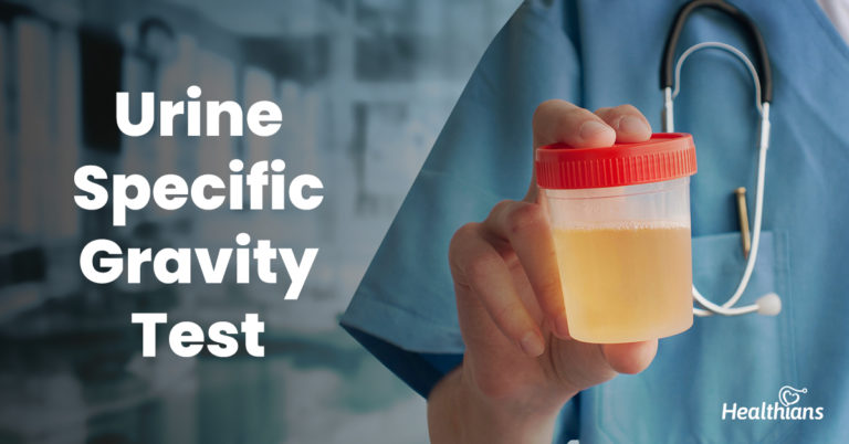 urine-specific-gravity-test-a-test-to-know-the-urine-concentration