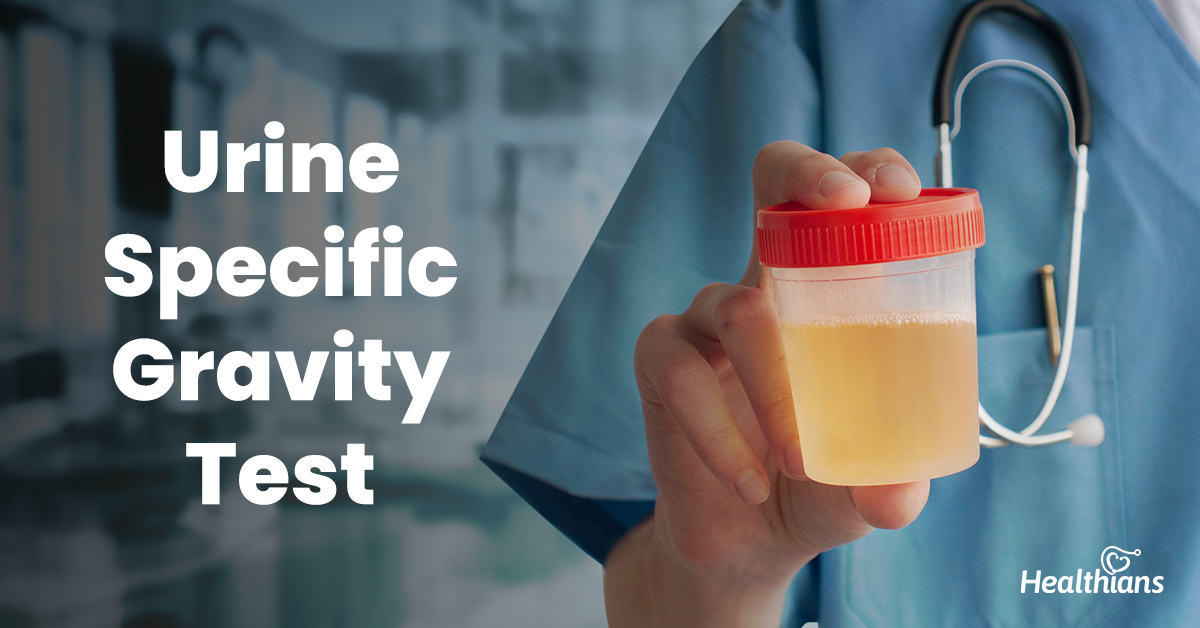 Urine Specific Gravity Test A Test To Know The Urine Concentration