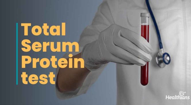 Total Serum Protein test