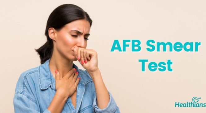 Acid-Fast Bacillus (AFB) Smear Testing:  What You Need to Know
