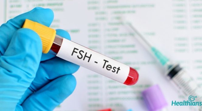 FSH Test: What do the results say about your fertility?