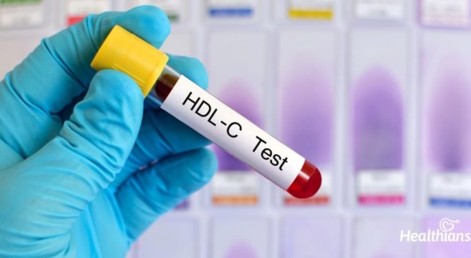 HDL Cholesterol Test – Need, Results & Preparations