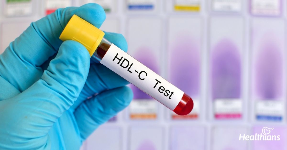 HDL cholesterol test - Healthians