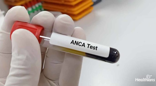 ANCA Test – Need, Uses & Results