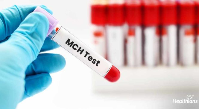 Mean Corpuscular Haemoglobin (MCH) Test