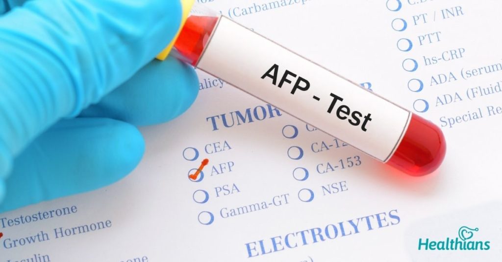 What You Need To Know About AlphaFetoprotein (AFP) Test