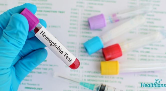 Hemoglobin Test – What does it say about your health?
