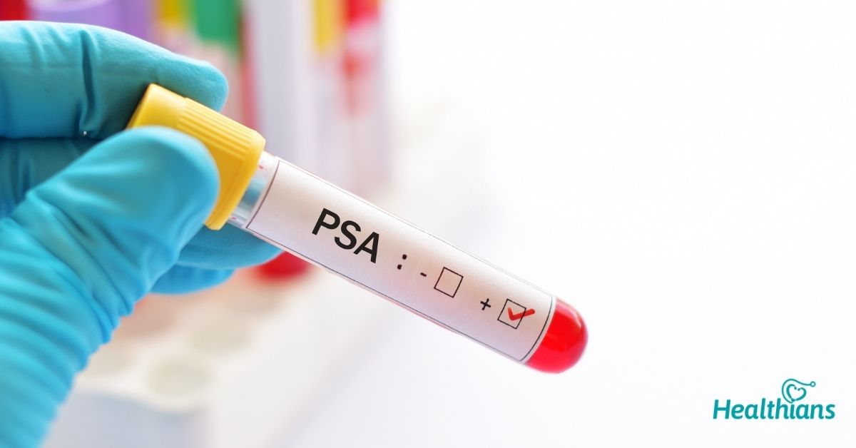 prostate-specific-antigen-psa-test-total-free-healthians-blog