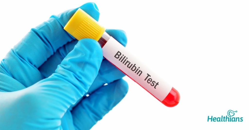 Bilirubin Direct Serum Test Need Uses Results HEALTHIANS BLOG