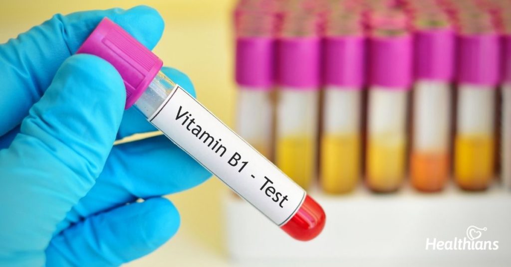 Vitamin B12 Test – Need, Results & Reference Range