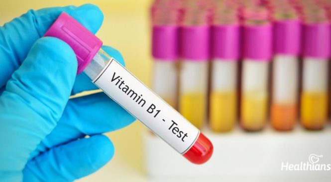 Vitamin B12 Test – Need, Results & Reference Range