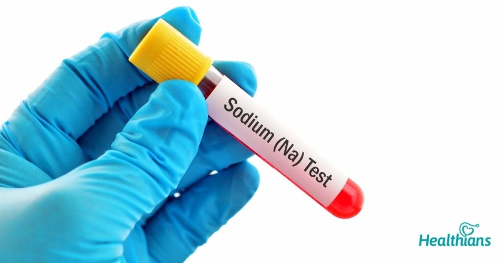 serum sodium normal range usa